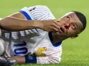 Euro 2024 : mauvaise nouvelle pour Kylian Mbappé, blessé au nez