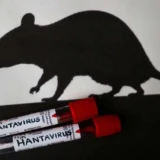 Hantavirus situation en Côte d'Ivoire